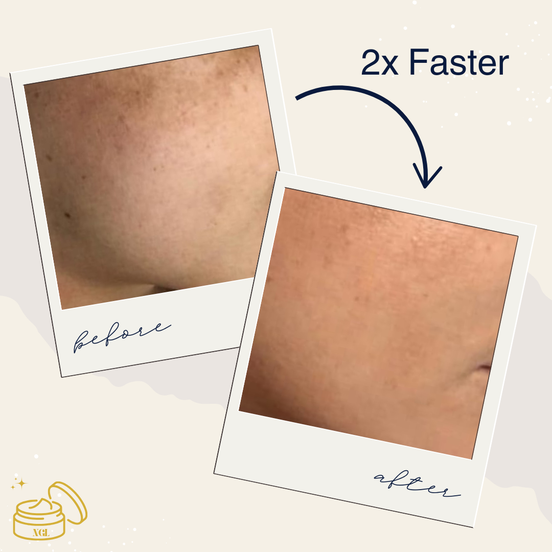 NGL 24K Gold Filter Cream – Brightening Treatment